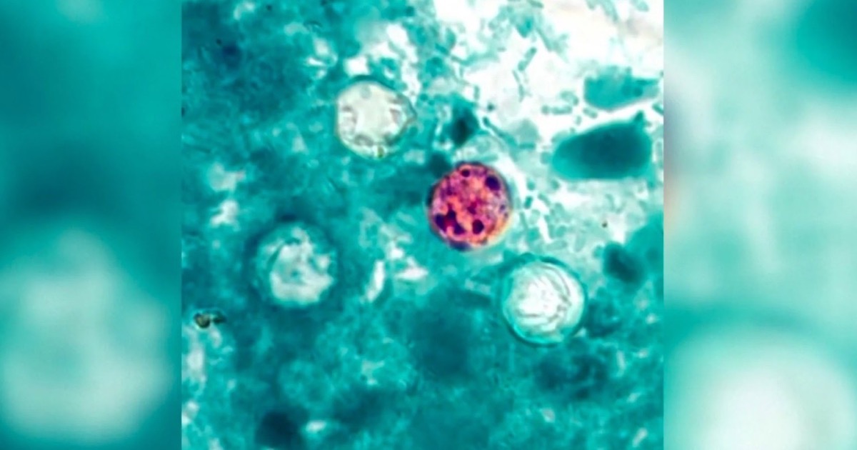 Cobertura del brote de Cyclospora en Michigan y Ohio: autoridades investigan lechuga y hojas verdes como posible fuente